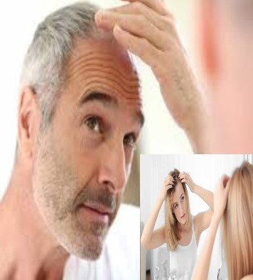 man-woman hair loss
